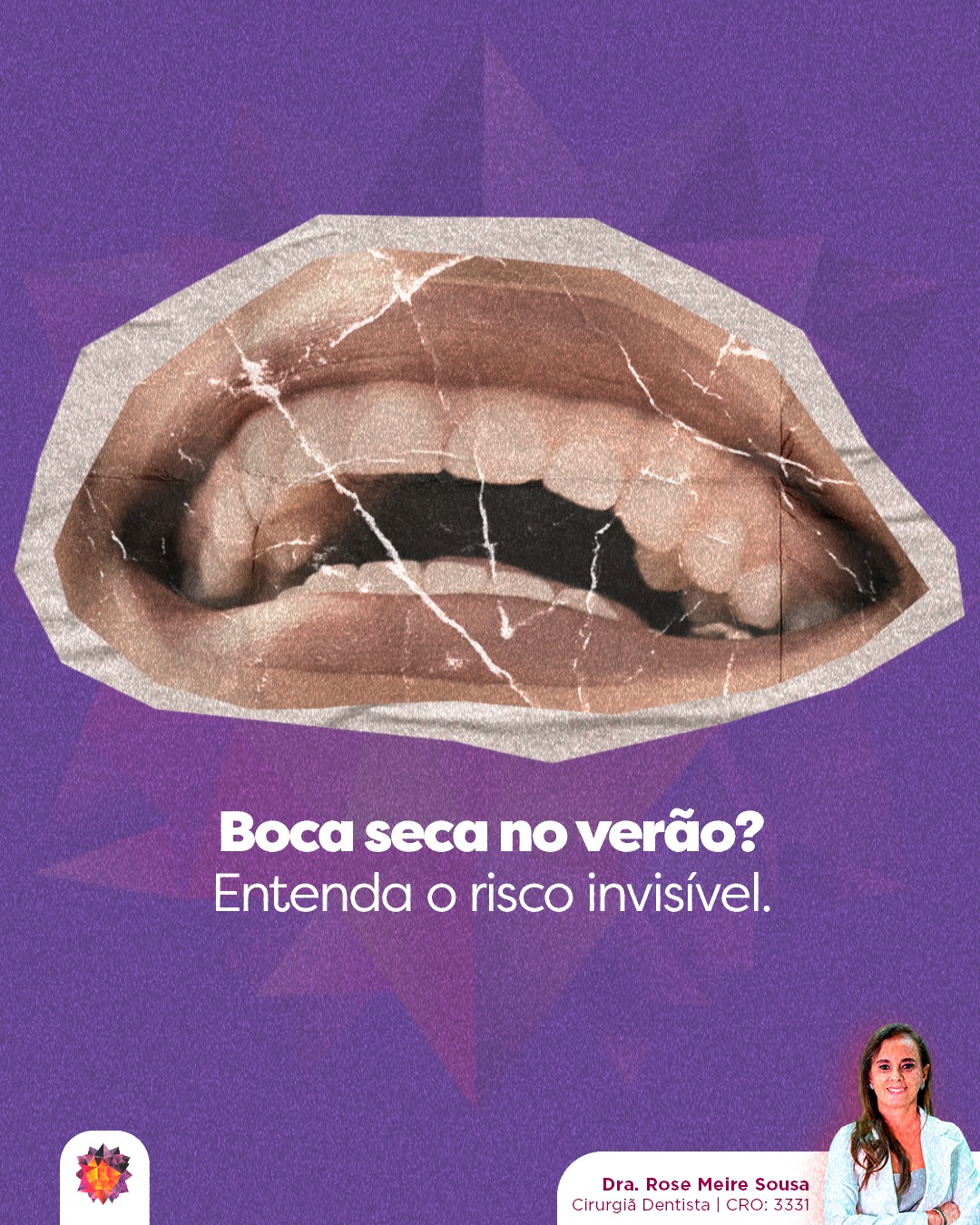 Com a chegada do verão e das temperaturas mais altas, focamos muito em proteger a pele do sol, mas esquecemos de proteger nossa boca da desidratação. ☀️💧Na odontologia, a saliva é considerada ouro líquido. Ela não serve apenas para "molhar" a boca; ela é a primeira linha de defesa do seu organismo. Uma boca bem hidratada garante:🔹 Controle do pH: A saliva neutraliza a acidez que causa a erosão do esmalte e as cáries.
🔹 Limpeza natural: Ela ajuda a remover resíduos de alimentos (função de autolimpeza).
🔹 Equilíbrio da microbiota: Sem saliva suficiente (boca seca), as bactérias nocivas se proliferam mais rápido, causando mau hálito e gengivite.Nesta época, aumentamos o consumo de bebidas alcoólicas e açucaradas, que desidratam ainda mais. Por isso, a regra é clara: para cada copo de drink ou refrigerante, um copo de água.A saúde começa pela boca, e a proteção começa com um simples gole de água. Hidrate-se!Dra. Rose Meire Sousa
Cirurgiã Dentista | CRO: 3331#odontologia #medicinaintegrativa #cirurgiãdentista #dentista #dentes #saúdebucal #saúde #ozonioterapia #inteligênciaemocional #saúdemental #mastigação