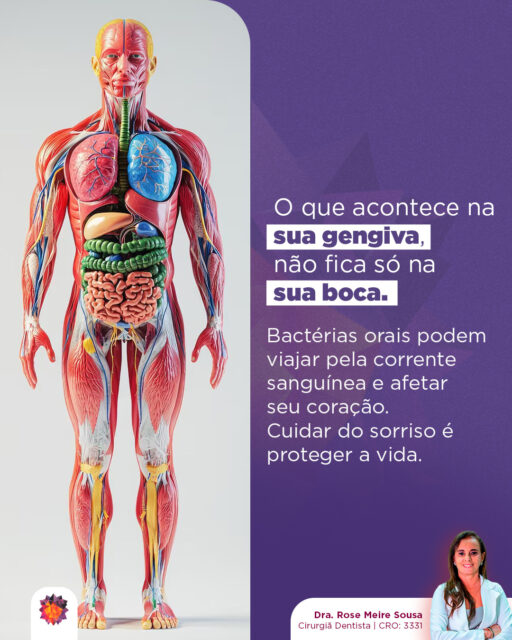 Você já parou para pensar que a sua boca não é um "departamento isolado" do resto do corpo?Muitas vezes, ignoramos um sangramento na gengiva achando que é algo simples. Mas, sob um olhar sistêmico, esse sangramento significa que existe uma "porta aberta" para que bactérias nocivas caiam na sua corrente sanguínea.E é aí que mora o perigo invisível.Estudos mostram que microrganismos presentes em doenças periodontais podem viajar pelo corpo e se alojar em órgãos vitais, como o coração, aumentando o risco de doenças cardiovasculares e endocardite.No meu consultório, o check-up vai muito além de procurar cáries. Nós avaliamos a saúde da sua gengiva como um indicador de saúde global.⚠️ Lembre-se: Gengiva saudável não sangra. Se você nota sangue ao escovar ou passar o fio, seu corpo está pedindo ajuda.Cuidar do sorriso é, literalmente, proteger a vida.
Vamos verificar como está a sua saúde bucal? Link na bio para agendamento
Dra. Rose Meire Sousa
Cirurgiã Dentista | CRO: 3331#odontologia #medicinaintegrativa #cirurgiãdentista #dentista #dentes #saúdebucal #saúde #ozonioterapia #inteligênciaemocional #saúdemental #mastigação