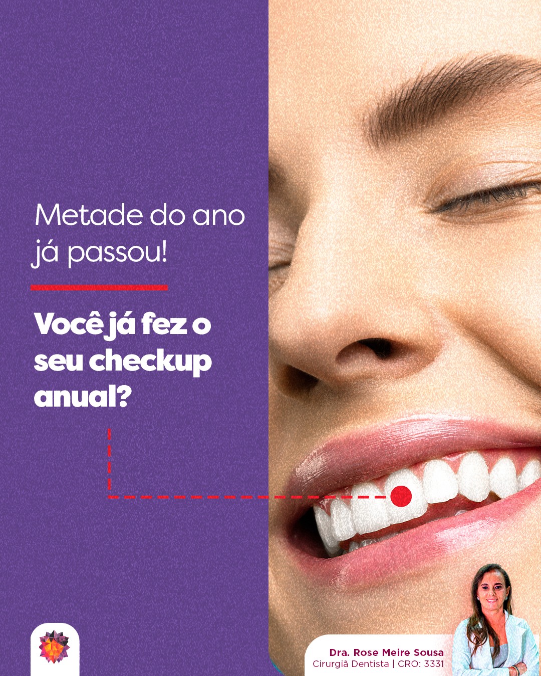 O ano já chegou na metade e muitas vezes esquecemos de dar atenção ao que é essencial: a saúde bucal. 🦷
O checkup anual é a oportunidade ideal pra você avaliar dentes, gengiva, função da mandíbula e hábitos que podem impactar seu bem-estar sem que você perceba.Agendar sua consulta é um cuidado simples que evita problemas maiores e mantém seu sorriso saudável durante todo o ano. Não se deixe para depois. Marque sua avaliação e cuide de você com atenção e carinho. ❤️Dra. Rose Meire Sousa
Cirurgiã Dentista | CRO: 3331#odontologia #medicinaintegrativa #cirurgiãdentista #dentista #dentes #saúdebucal #saúde #ozonioterapia #inteligênciaemocional #saúdemental #mastigação