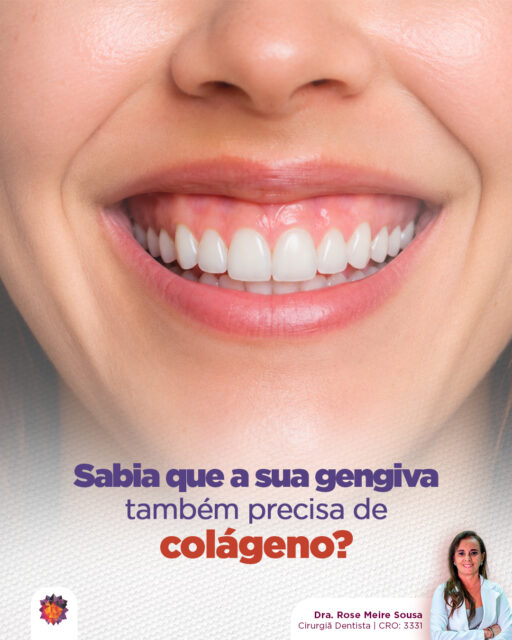 Muitas pessoas não sabem, mas o colágeno não é importante só para a pele: ele também fortalece gengiva e tecidos de suporte dos dentes, ajudando a manter tudo saudável e resistente. 😄Você pode estimular a produção de colágeno com uma alimentação equilibrada e rica em nutrientes, como:
Frutas cítricas (laranja, limão, acerola) – vitamina C
Carnes magras e ovos – aminoácidos essenciais
Peixes e frutos do mar – colágeno natural e ômega-3
Vegetais verdes escuros – antioxidantes que protegem tecidos
Oleaginosas e sementes – ajudam na regeneração celularE aí, você tem ingerido alguns desses itens com frequência? Pequenos cuidados na alimentação ajudam a manter gengivas fortes e dentes protegidos.Dra. Rose Meire Sousa
Cirurgiã Dentista | CRO: 3331#odontologia #medicinaintegrativa #cirurgiãdentista #dentista #dentes #saúdebucal #saúde #ozonioterapia #inteligênciaemocional #saúdemental #mastigação
